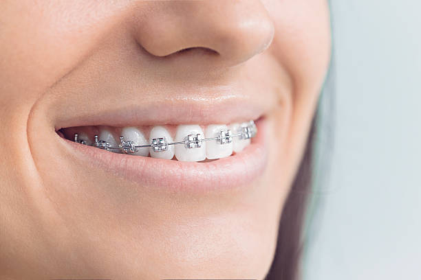 Best Veneers and Lumineers  in Manito, IL